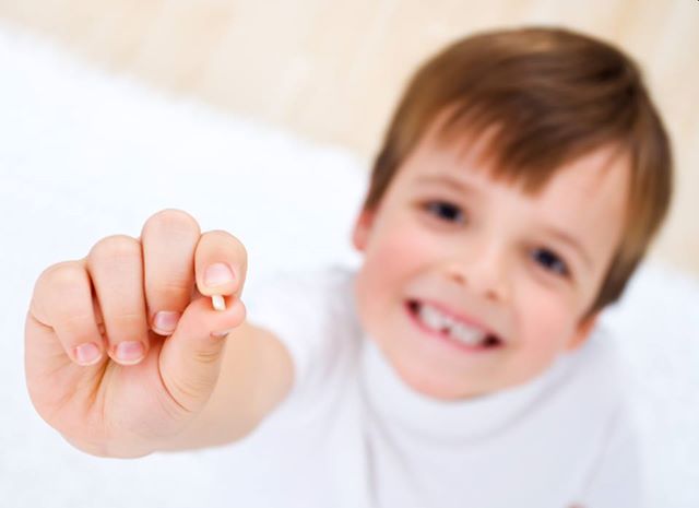 Chipped tooth