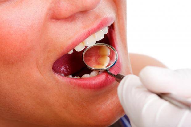 Oral Cancer