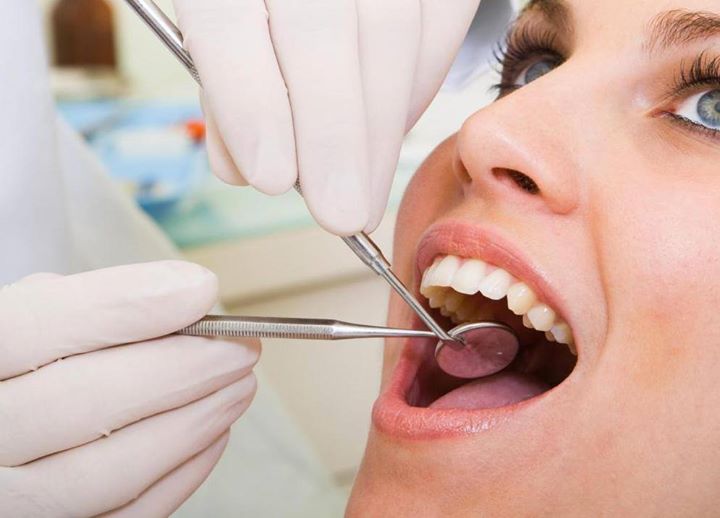 smile makeover