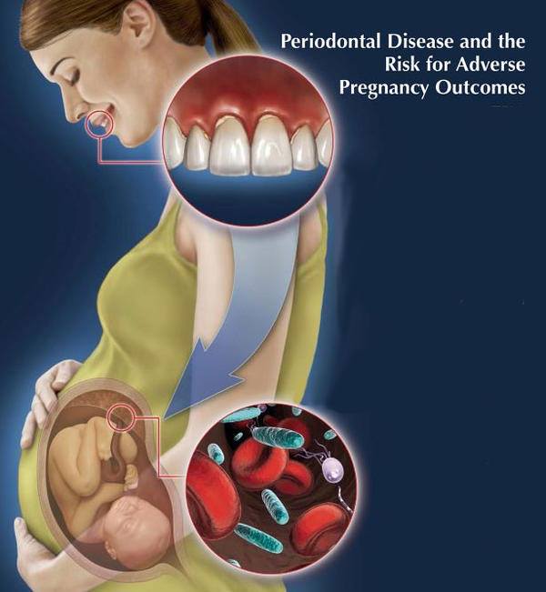 pregnancy care