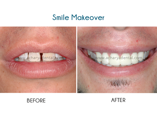 Dave smile makeover