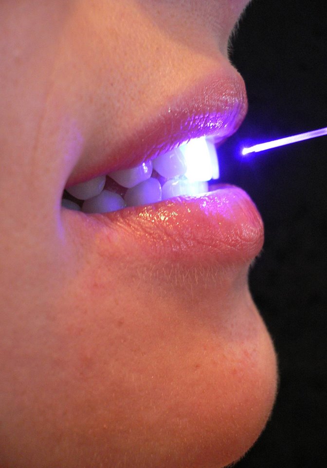laset dentistry