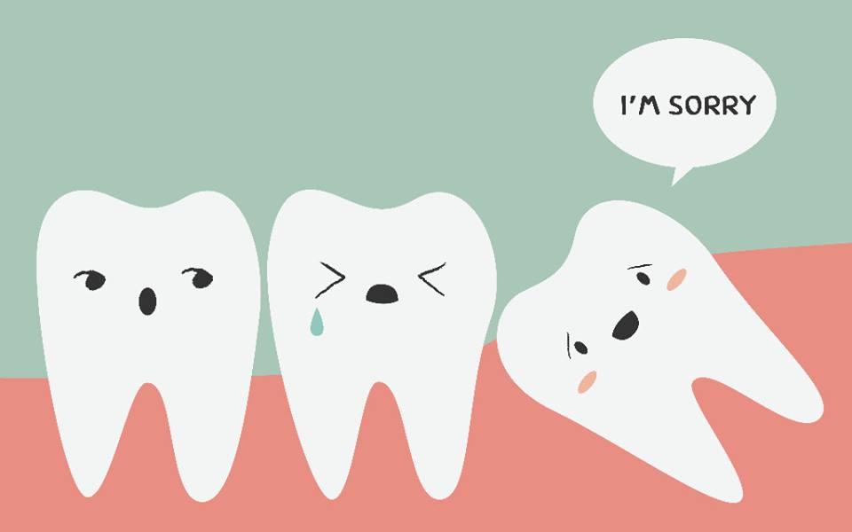 wisdom teeth