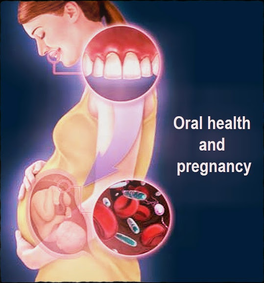 Oral health and pregnancy