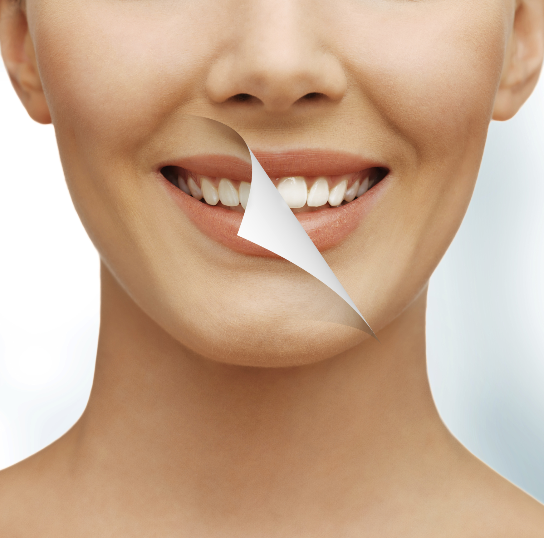 Teeth Whitening