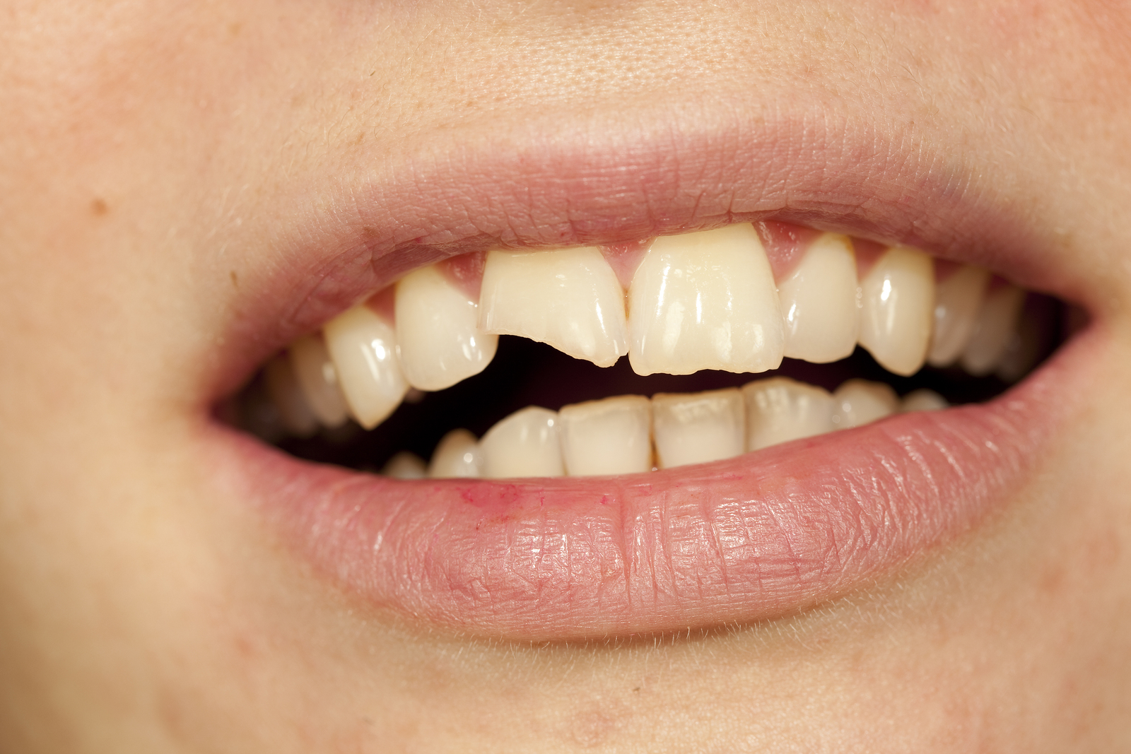 Accidents & Dental Problems