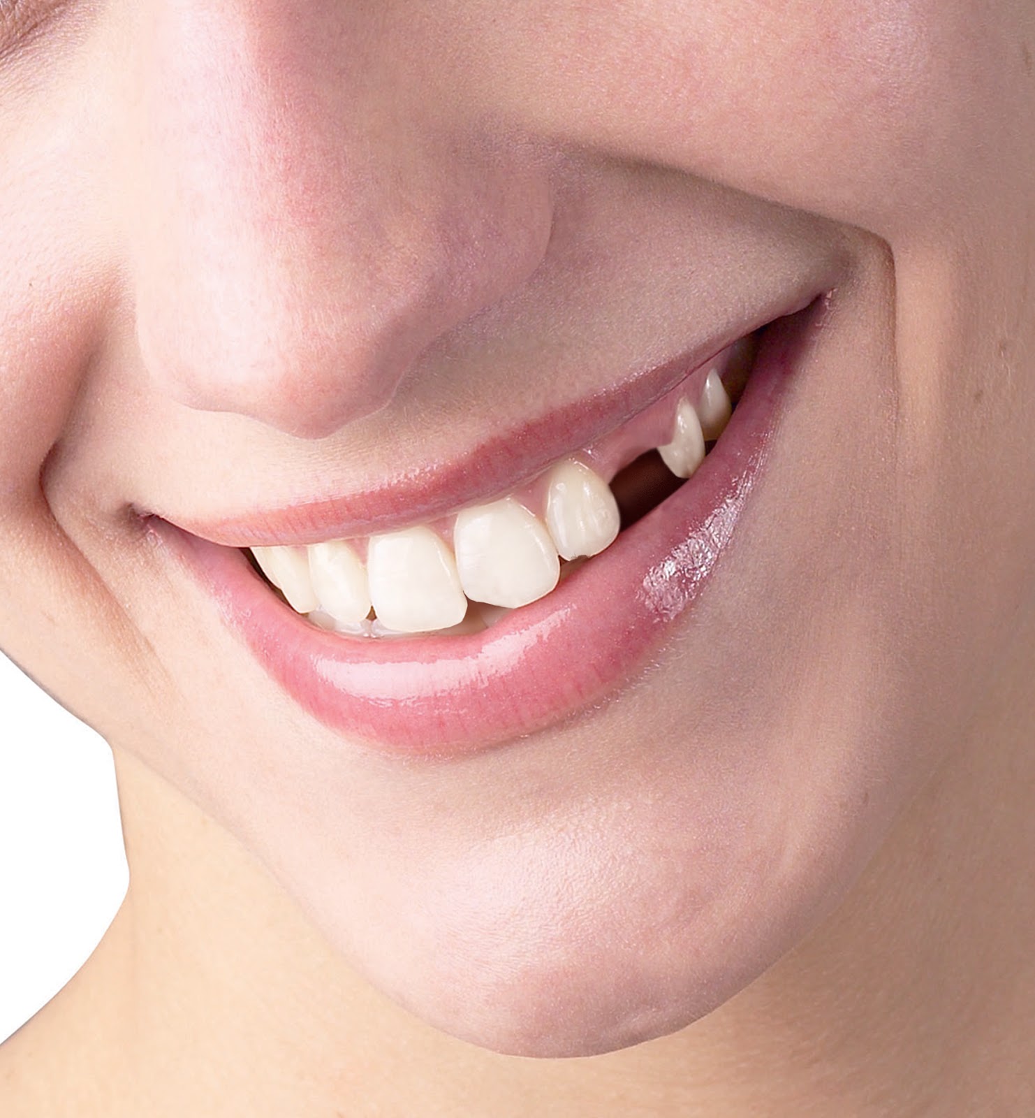 Knocked out Tooth
