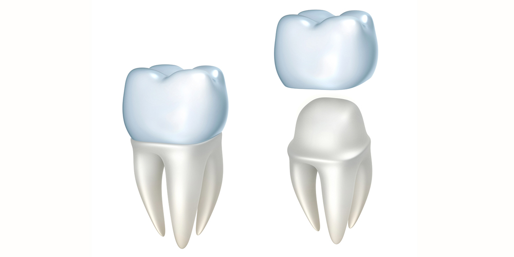 Teeth Fixing