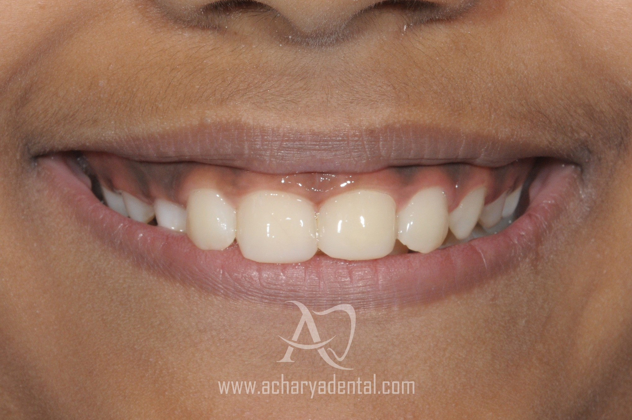 After smilemakeover diagnosis image