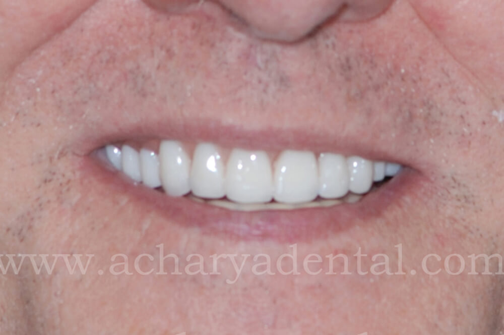 dental after diagnosis