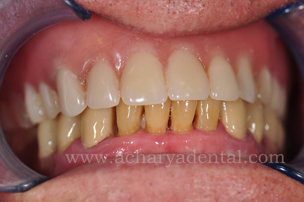 dental before diagnosis