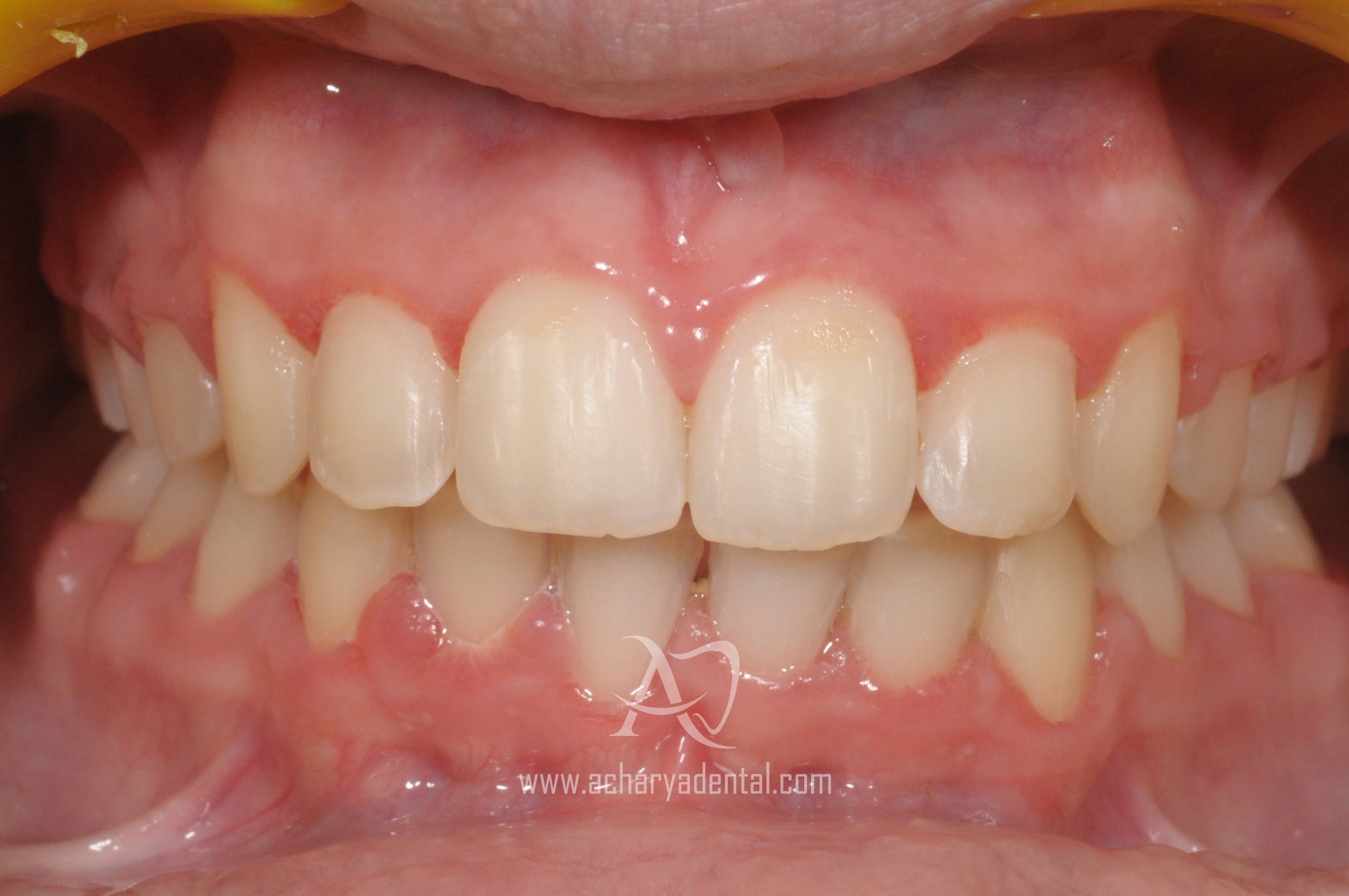 after ortho case