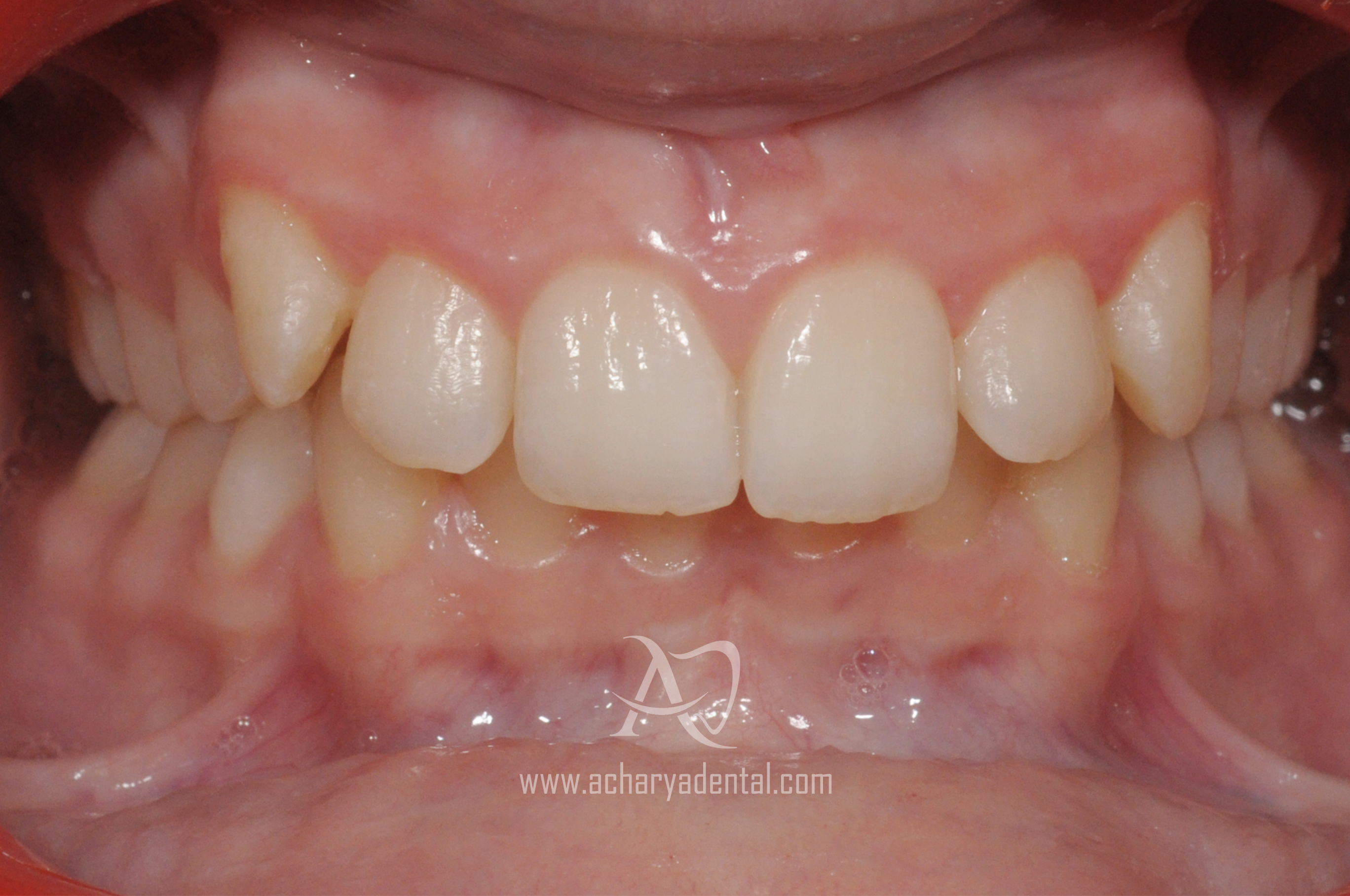 before ortho case