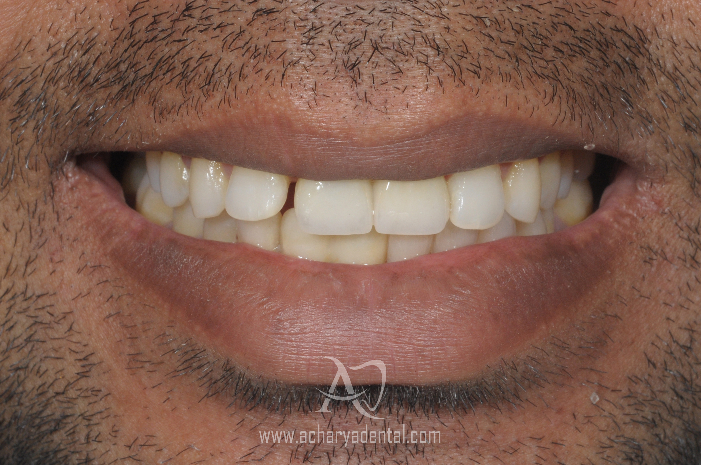 before smile makeover diagnosis