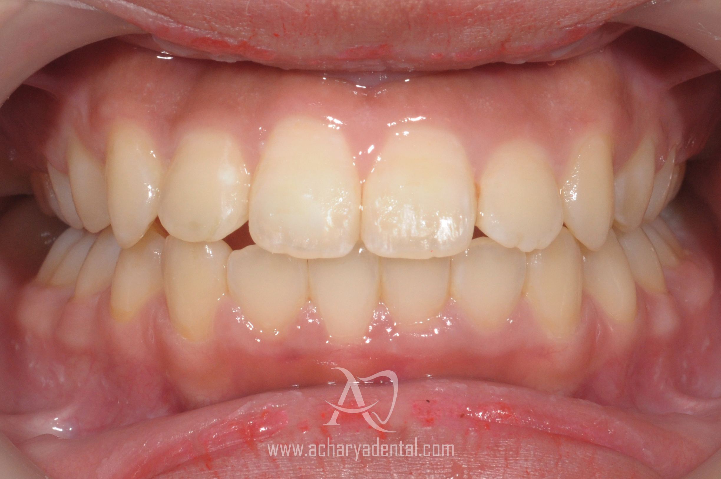 orthodontics after