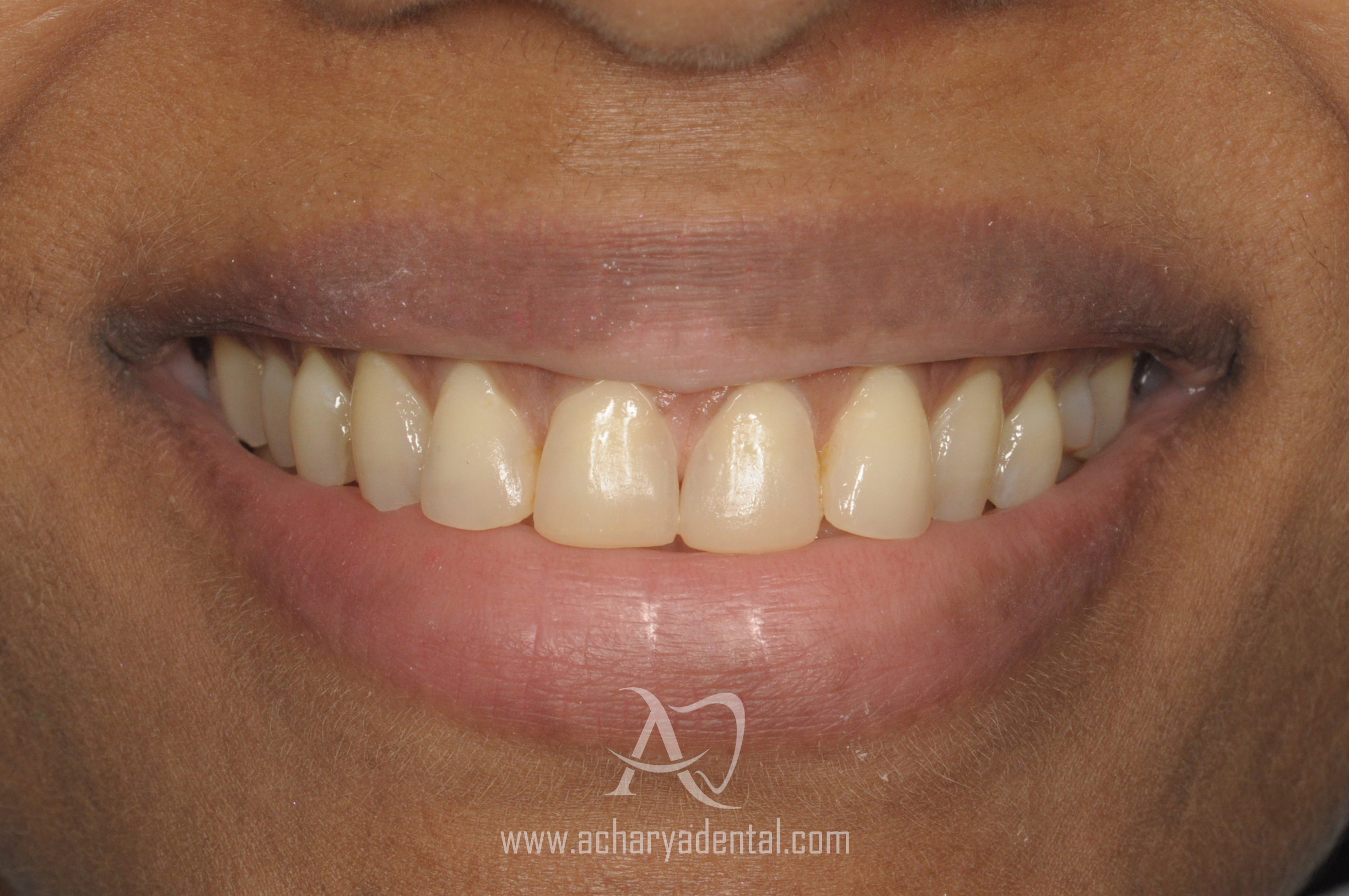 smilemakeove-after (1)