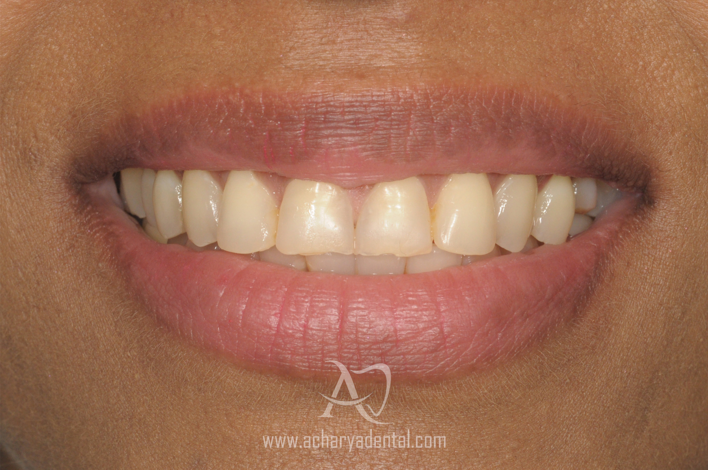 smilemakeover-before (1)