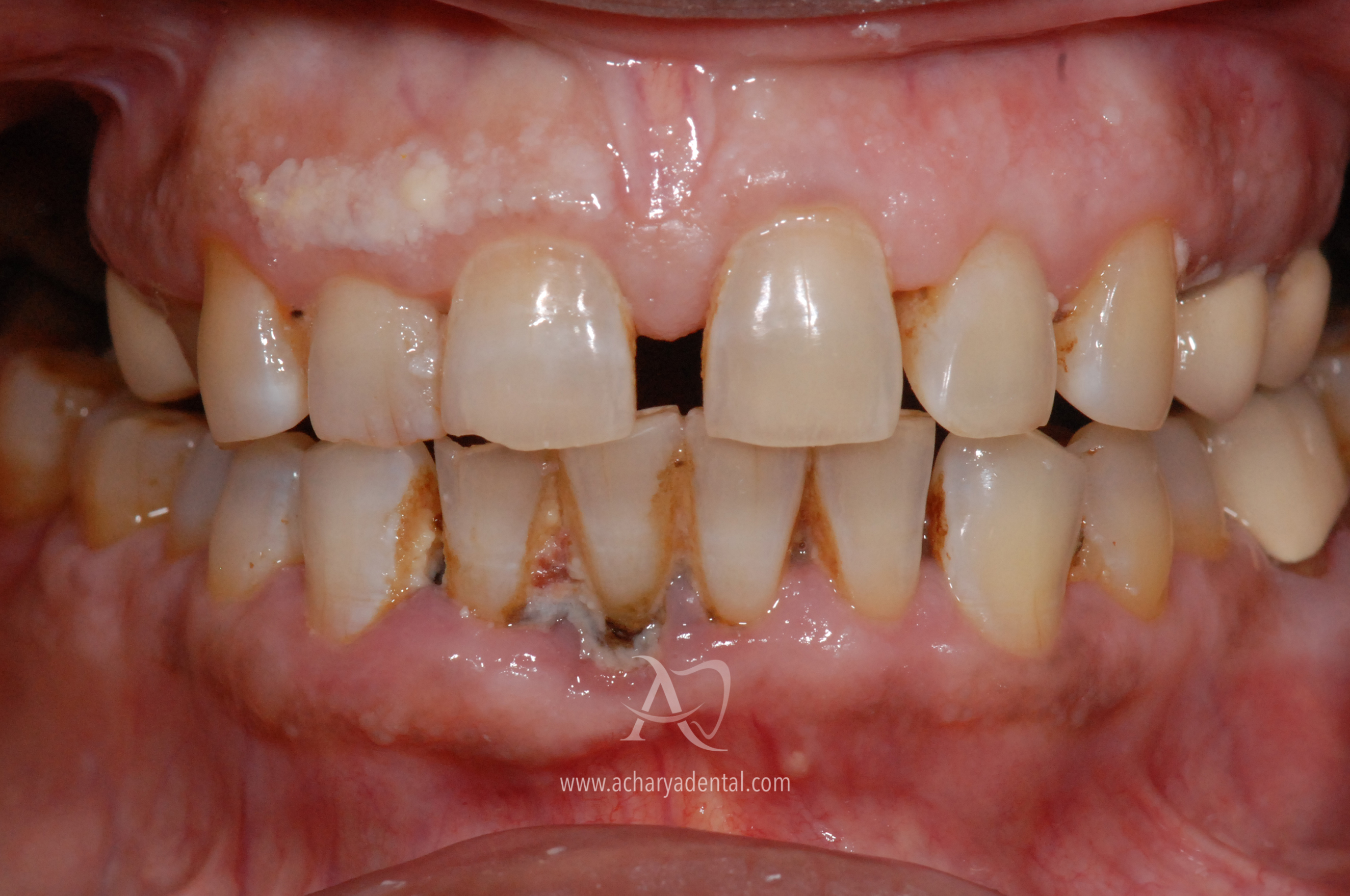 Before image