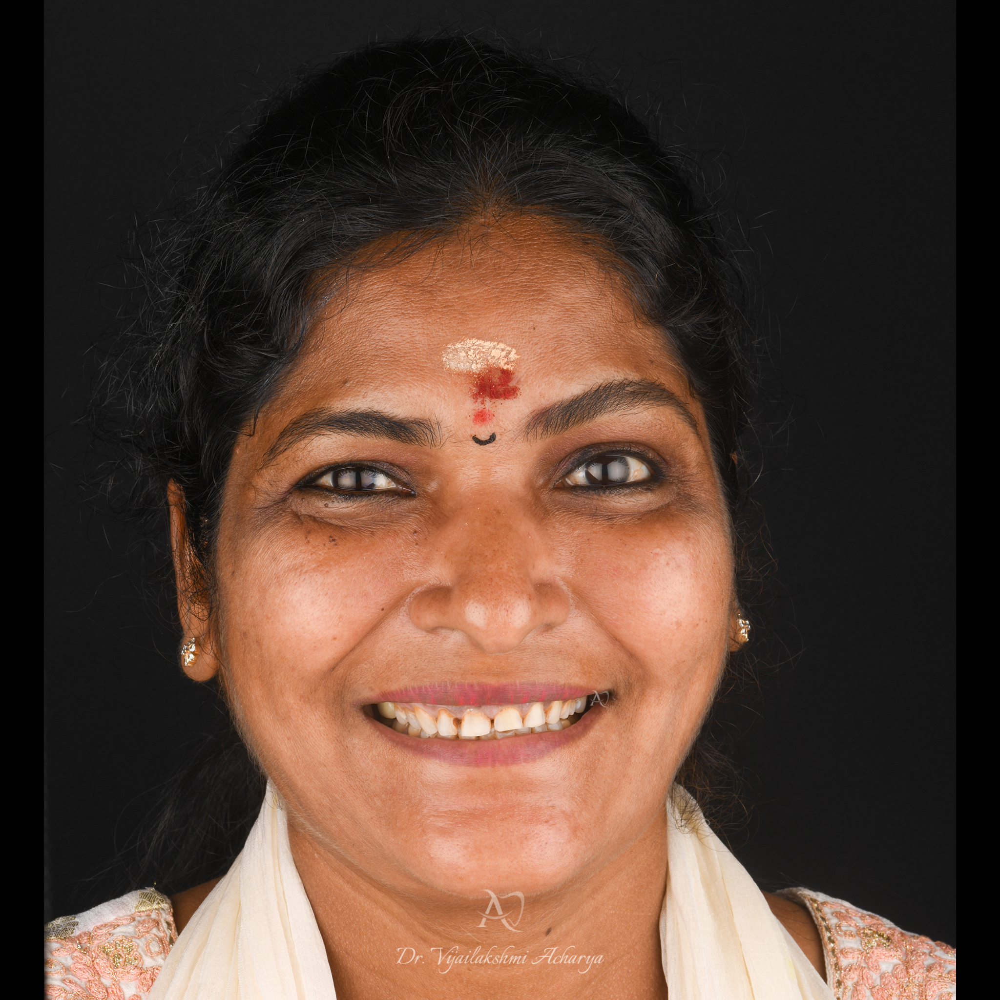 before smile makeover