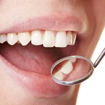 Oral Cancer Screening