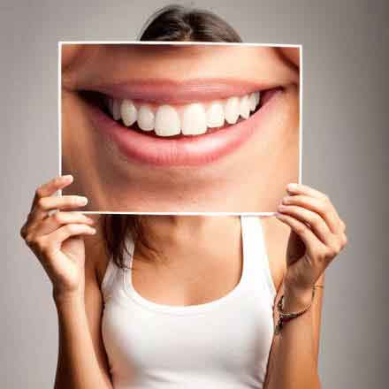Teeth Cleaning