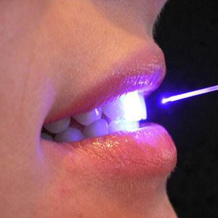 Laser Dentistry